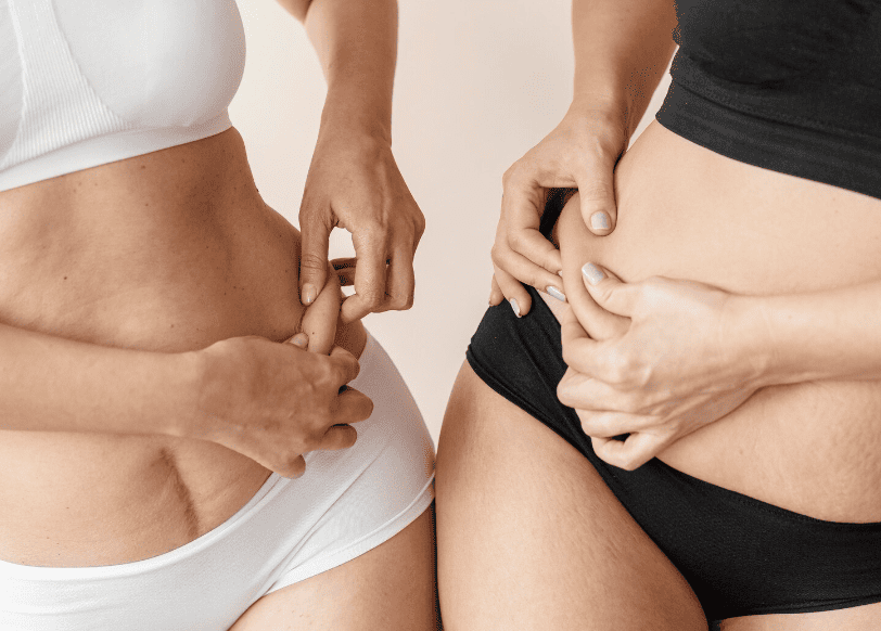 Tratamentos para celulite