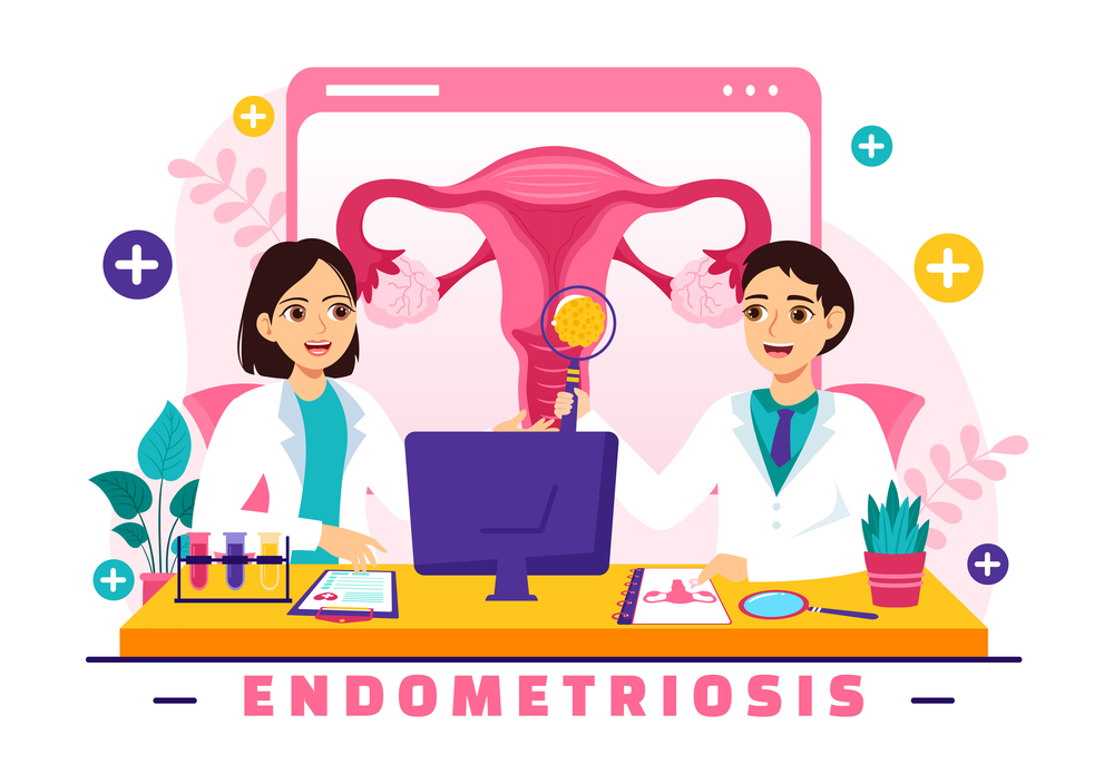 Quais são os tipos de endometriose e como identificá-los? 3 tipos de endometriose 2
