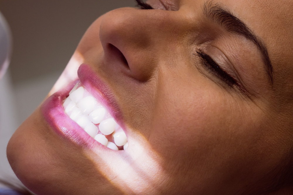 Como clarear os dentes amarelados? 2 formas de branquear os dentes 2