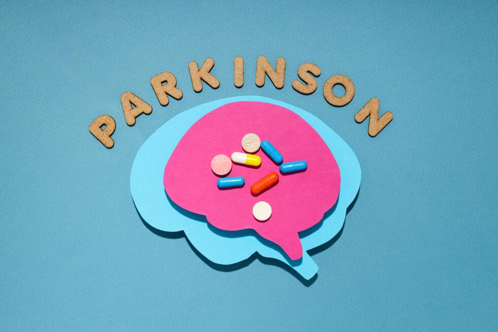 Quando os remédios para Parkinson perdem o efeito: entenda o fenômeno "Off" e as discinesias 1 remédios para Parkinson